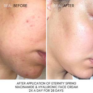 Eternity Spring Niacinamide and Hyaluronic Face Cream 120ml image 1