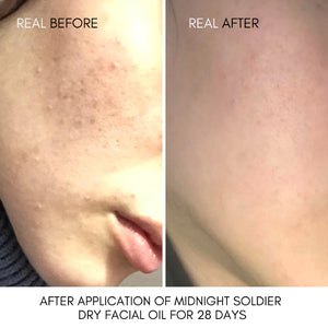 Midnight Soldier Rosehip-infused Oil Serum image 1