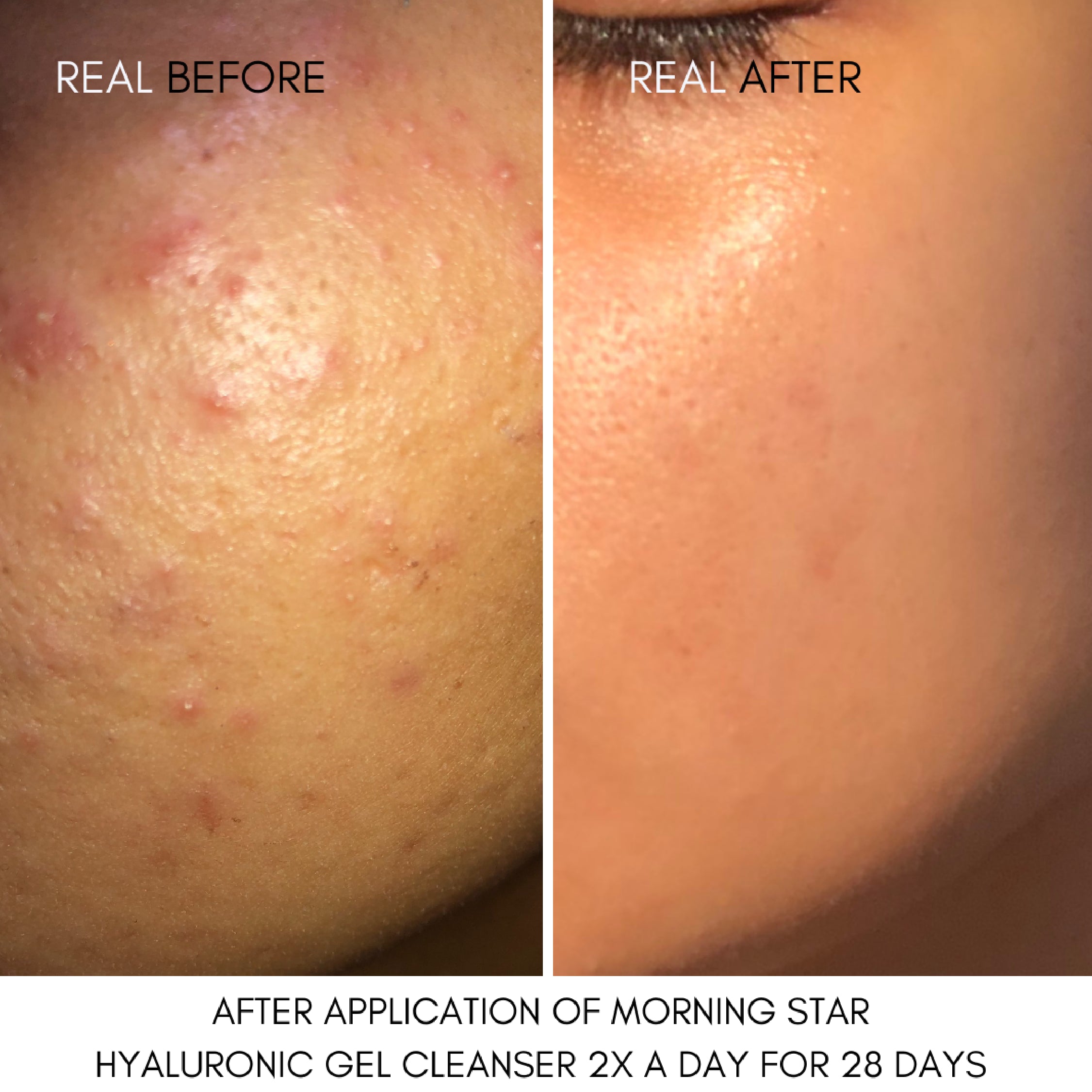 Morning Star Hyaluronic Gel Cleanser image 1
