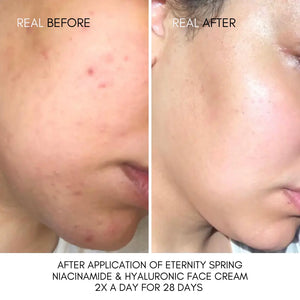 9% Niacinamide Kit: Eternity Spring Niacinamide & Hyaluronic Face Cream 50ml & MarineBio 5% Niacinamide Serum With Panthenol B5 & Postbiotic Complex 30ml image 2