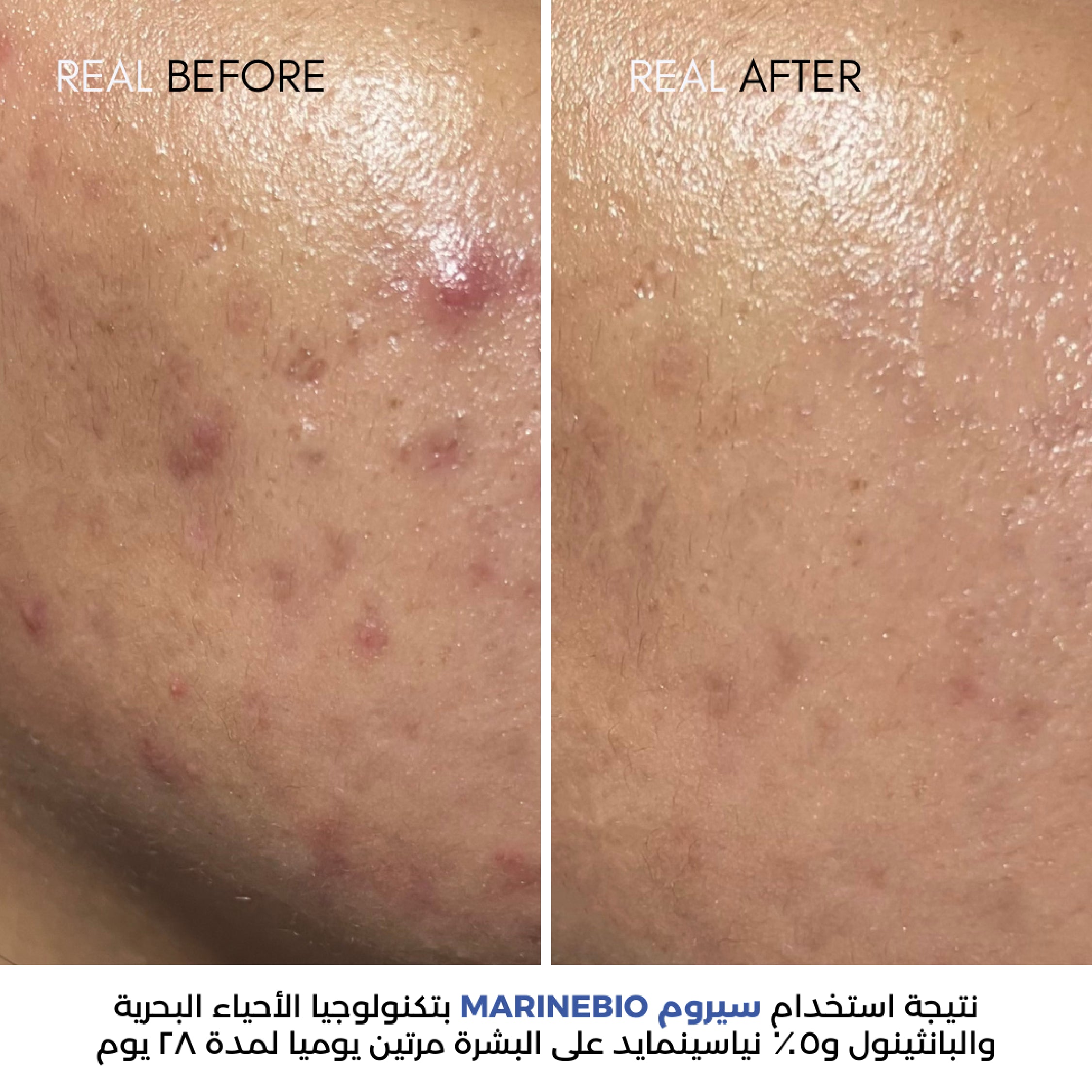 MarineBio 5% Niacinamide Serum image 1