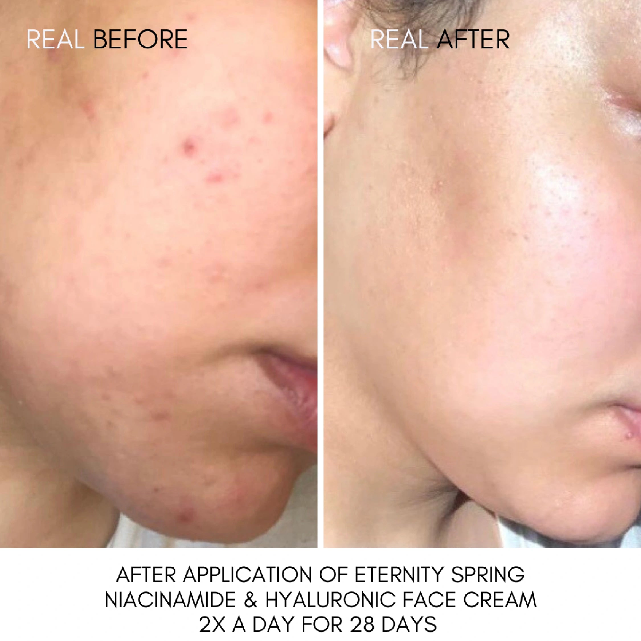 Eternity Spring Niacinamide and Hyaluronic Face Cream