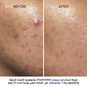 9% Niacinamide Kit: Eternity Spring Niacinamide & Hyaluronic Face Cream 50ml & MarineBio 5% Niacinamide Serum With Panthenol B5 & Postbiotic Complex 30ml image 1