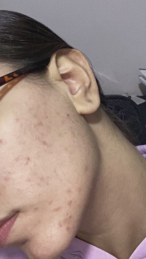 Super C 4X Serum
