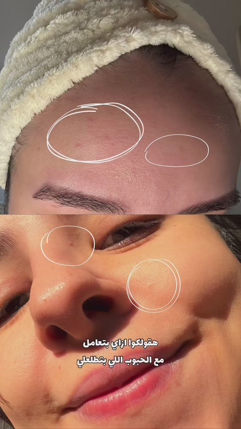9% Niacinamide Kit