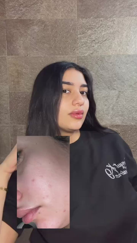 Super C 4X Serum